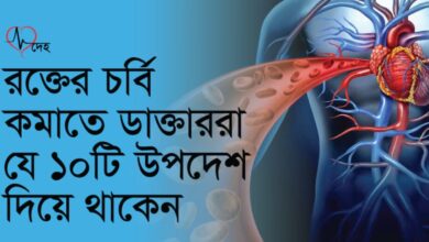 Photo of র’ক্তের চর্বি দূর করতে চিকিৎসকরা যে ১০টি উপদেশ দিয়ে থাকেন