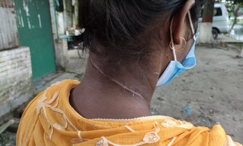 ধর্ষণে ব্যর্থ হয়ে স্কুলছাত্রীকে ছুরিকাঘাত, থানায় মামলা না নেয়ায় আদালতে বাবা